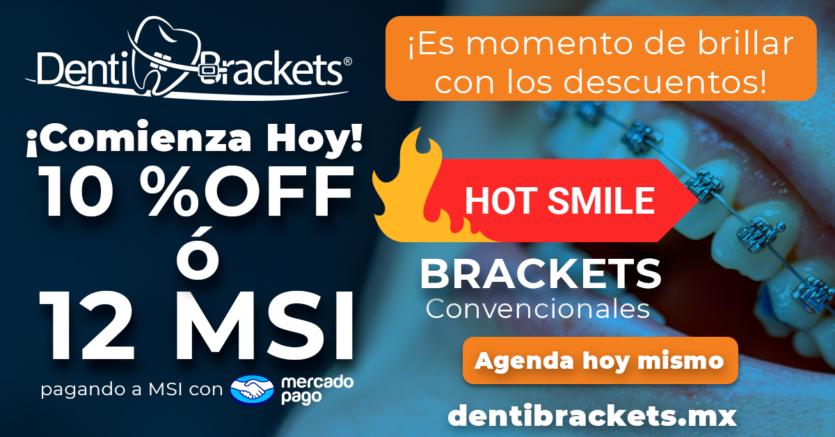 Dentibrackets®_hotsmaile2026_bracketsconvencionales