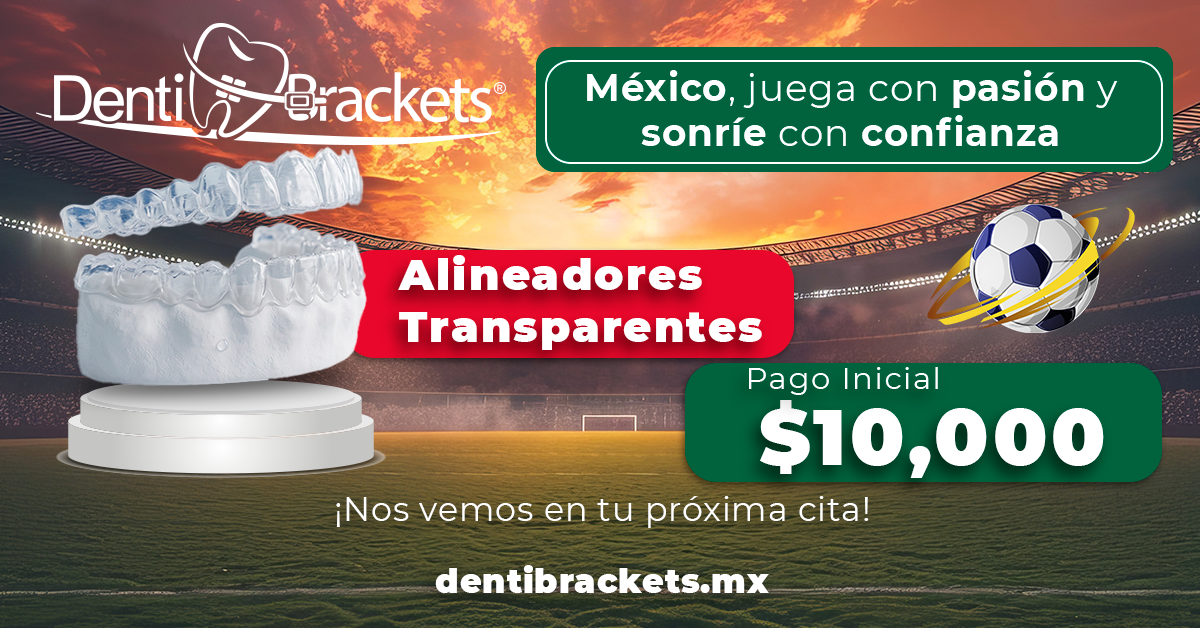dentibrackets®_alineadores transparentes_julio