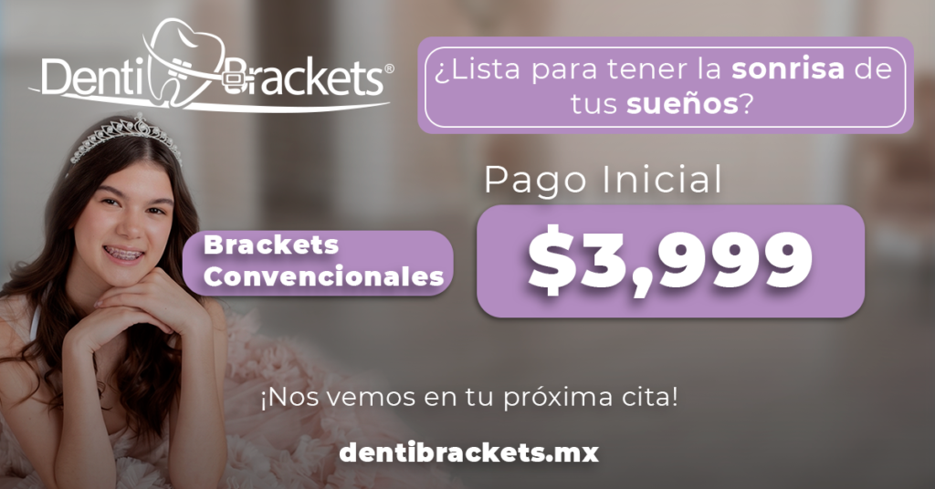 dentibrackets®_quinceañeras_quinceaños_xvaños_julio
